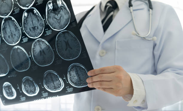 Best Neurologist In Abu Dhabi